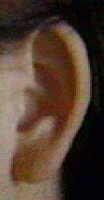 breast cyst ear